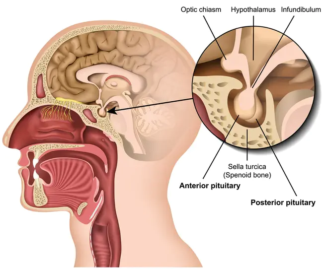 Pituitary Stalk : 垂体柄