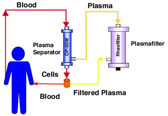 plasmapheresis : 血浆置换术