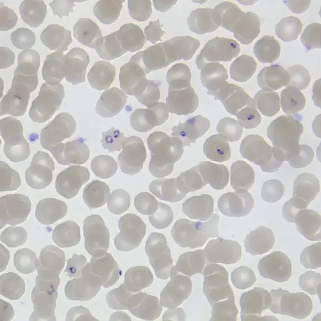 Plasmodium falciparum : 恶性疟原虫