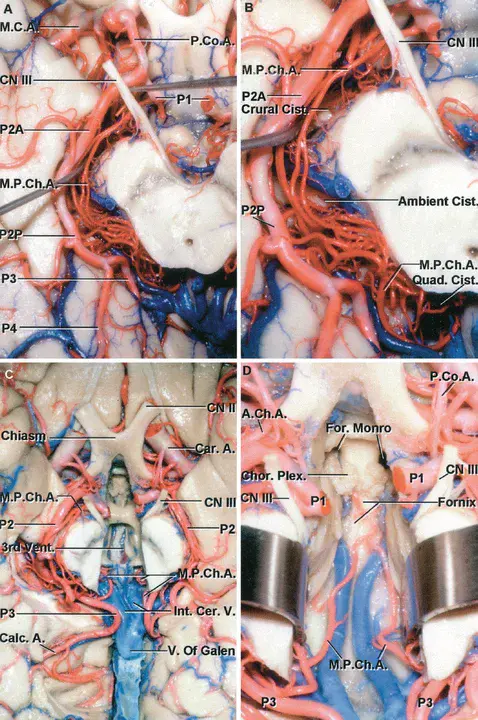 posterior commissure Neuroanatomy : 后连合神经解剖学