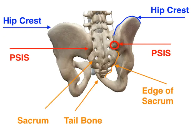 Posterior Fossa : 后颅窝