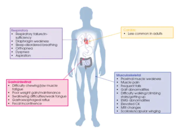 postpump syndrome : 后泵综合征