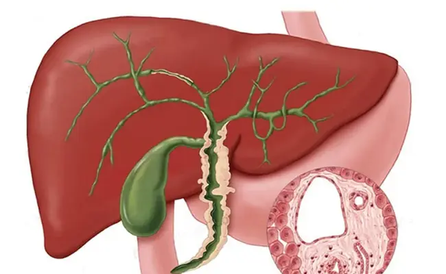 primary hyperaldosteronism : 原发性醛固酮增多症