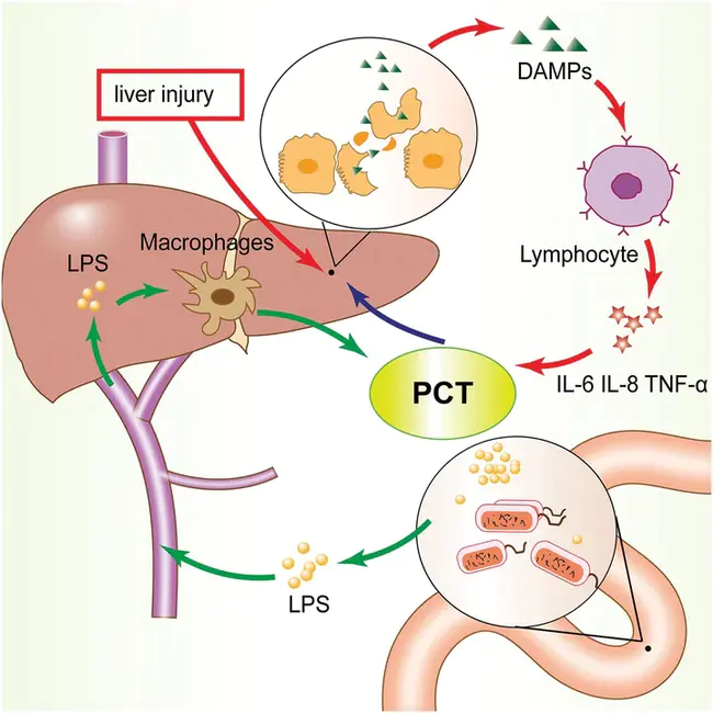 procalcitonin : 降钙素原