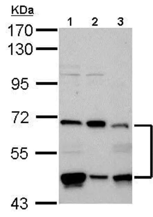 Prolyl Hydroxylase : 脯氨酰羟化酶