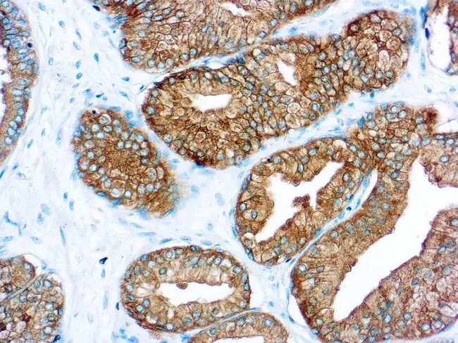 prostate-specific membrane antigen : 前列腺特异性膜抗原