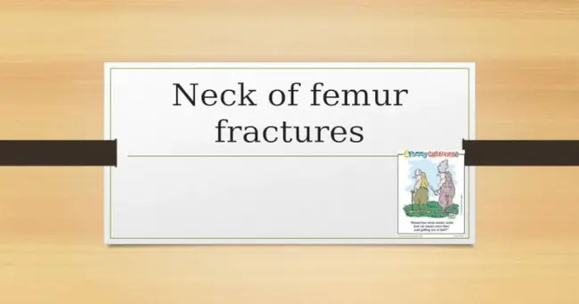 Proximal Femur : 股骨近端