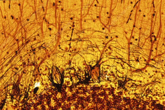 Purkinje cells Neuroanatomy : 浦肯野细胞神经解剖学