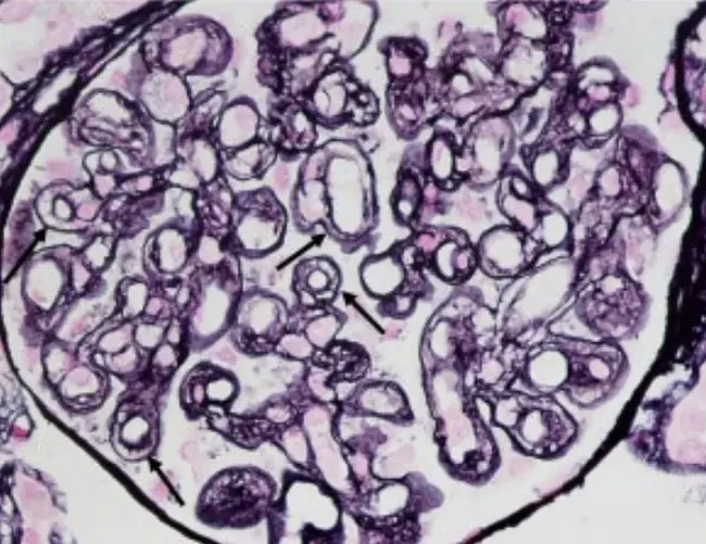 Renal Epithelial Cell : 肾上皮细胞