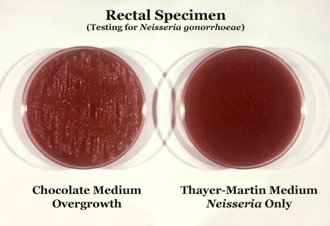 Selective Androgen Receptor Modulator : 选择性雄激素受体调节剂