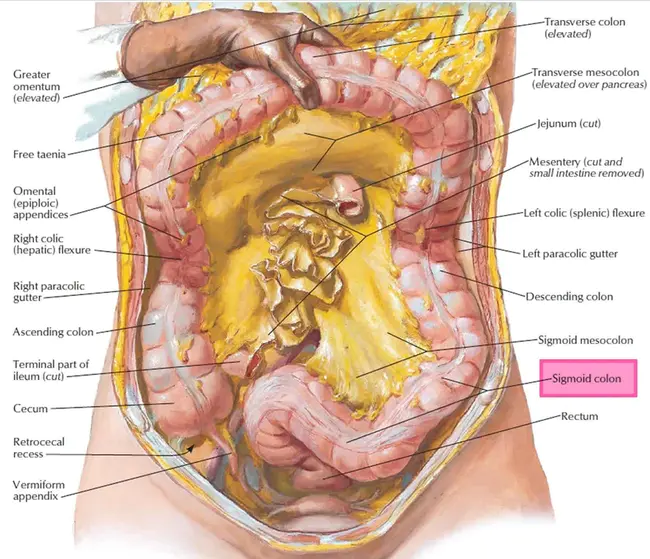 Sigmoid Colon : 乙状结肠