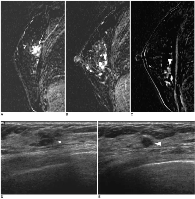 Solid and Cystic Tumour : 实性和囊性肿瘤