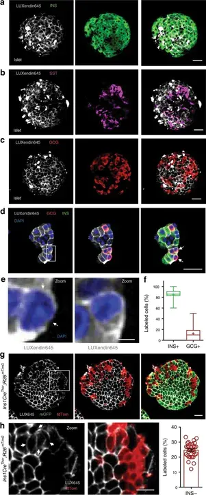 Somatostatin-Like Immunoreactivity : 生长抑素样免疫反应性