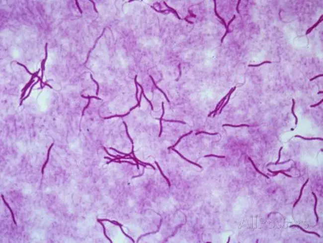 spiriform nucleus : 螺旋状核