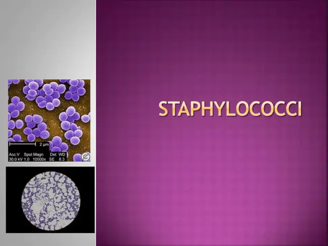 Staphylococcal Hemagglutinating Antibody : 葡萄球菌血凝素抗体