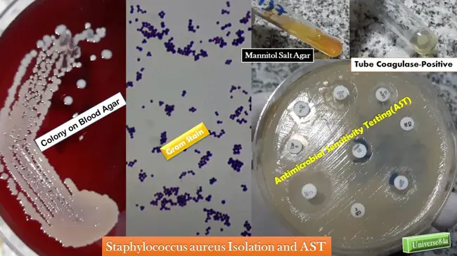 Staphylococcus Aureus Protease : 金黄色葡萄球菌蛋白酶