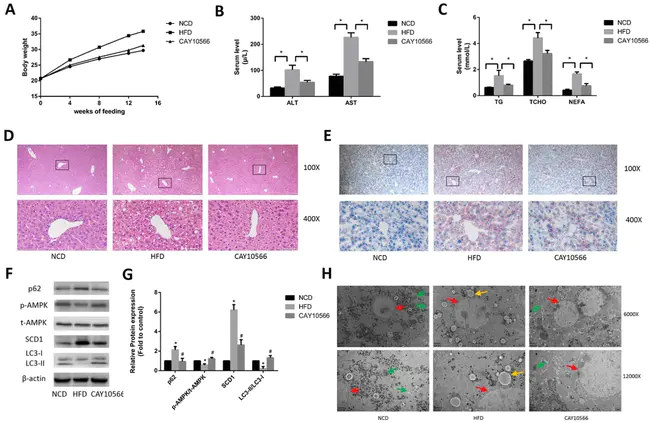 striatal enriched phosphatase : 纹状体富集磷酸酶