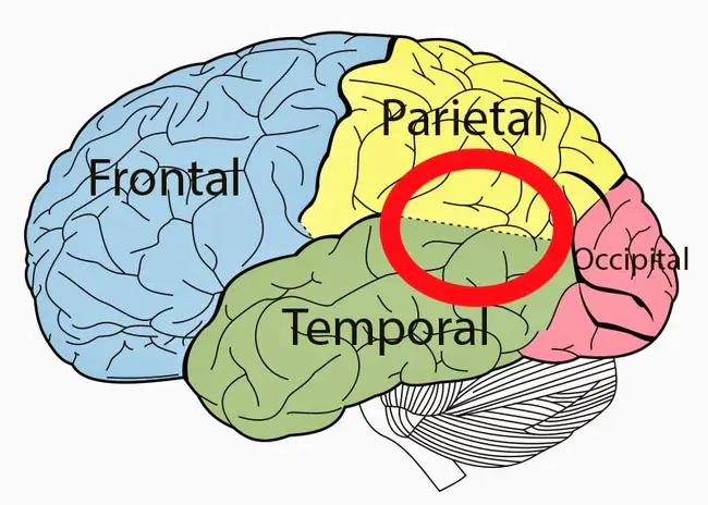 temporoparietal : 颞顶的