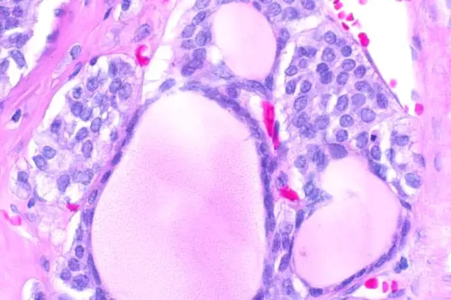 Thyroid Epithelial Cell : 甲状腺上皮细胞