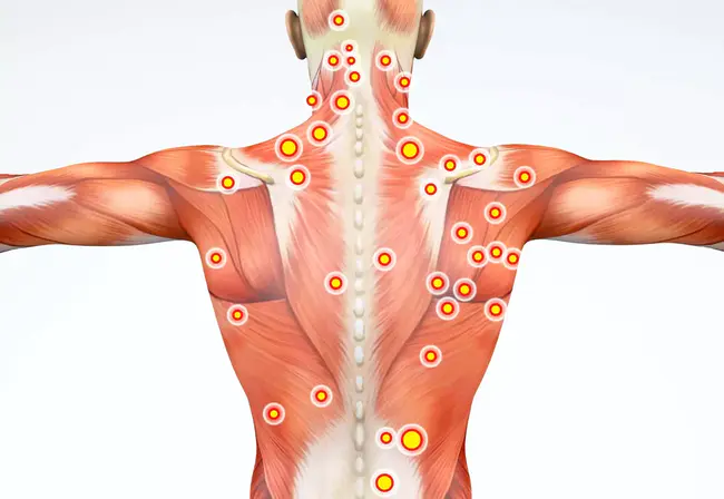 Trigger Point : 触发点