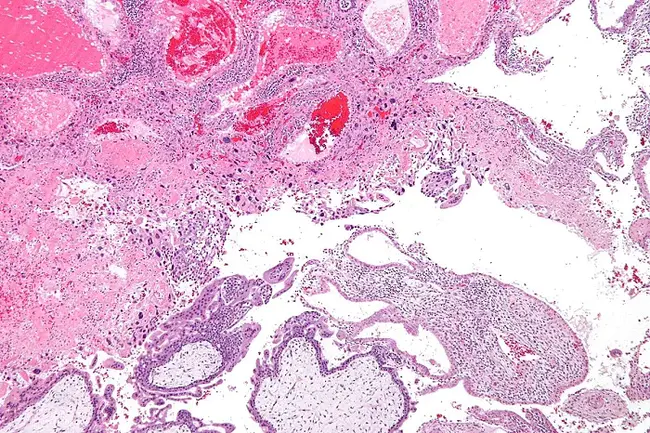 Trophoblast Cell : 滋养层细胞