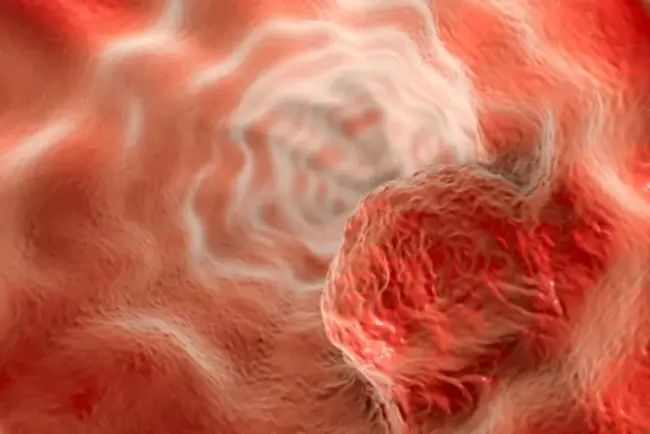 Tumour Cytogenetics : 肿瘤细胞遗传学