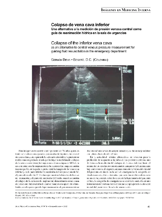 Vena Cava Occlusion : 腔静脉闭塞