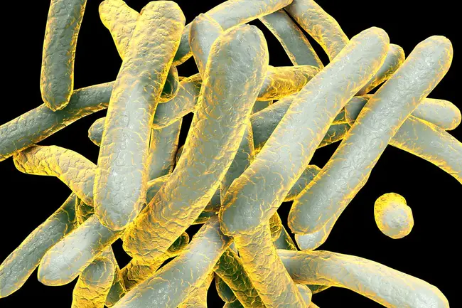 Tuberculosis Genotyping Laboratory Procedures : 结核基因分型实验室程序