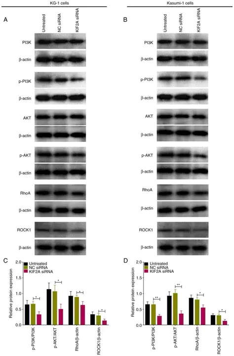 Kinase Homology Domain : 激酶同源域