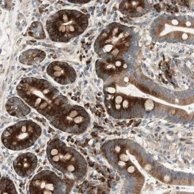 Apolipoprotein A1 : 载脂蛋白A1