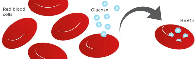 Hemoglobin A1c : 血红蛋白A1C