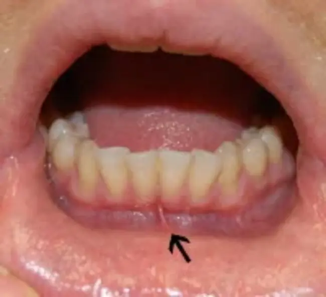 Oral Rehydration System : 口服补液系统