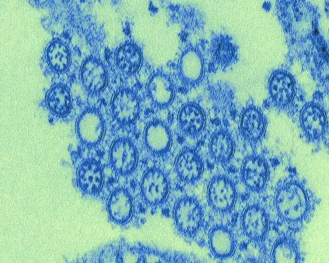 Influenza-like Illness Surveillance Network : 流感样疾病监测网