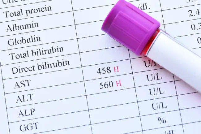 phosphatase and tensin homologue : 磷酸酶和紧张素同系物