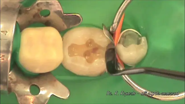 type III secretion system : III型分泌系统