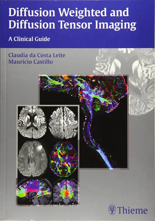 Diffusion Tensor Imaging : 扩散张量成像