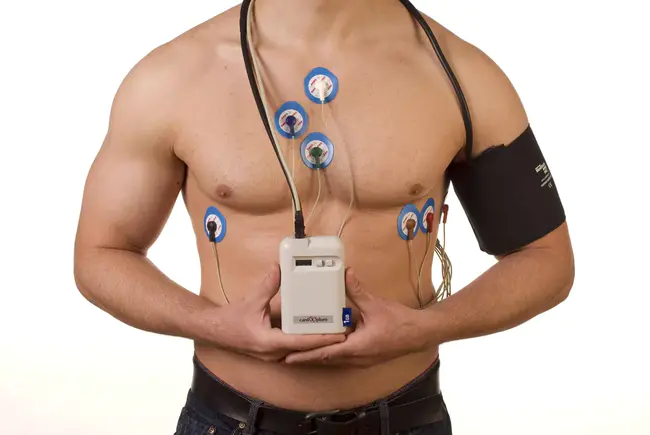 Holter Monitor : 动态心电图监视器