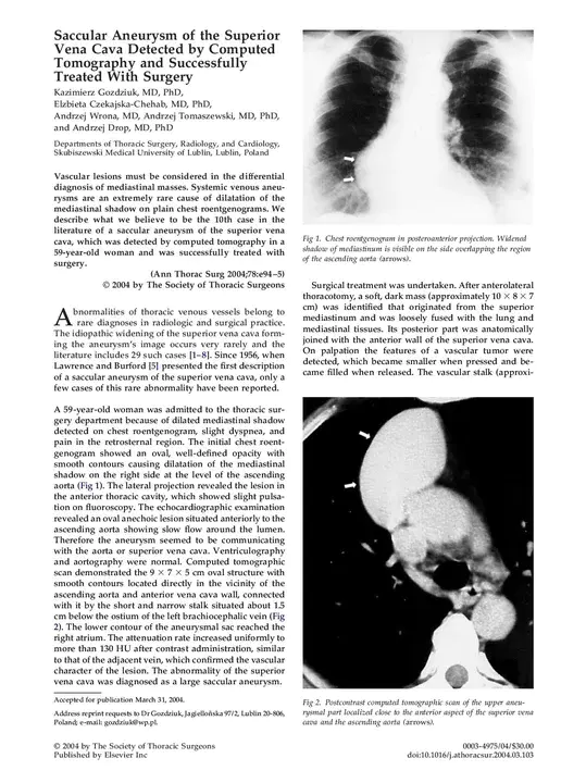 Open Versus Endovascular aneurysm Repair : 开放性与血管内动脉瘤修复