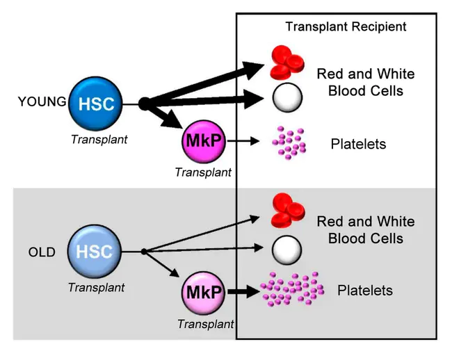 Hematopoietic Stem-Cell Transplantation : 造血干细胞移植