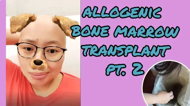 Allogenic Bone Marrow Transplantation : 同种异体骨髓移植