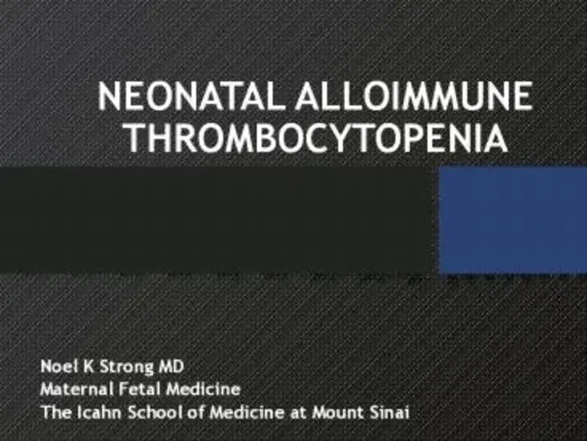 neonatal alloimmune thrombocytopenia : 新生儿同种免疫性血小板减少症