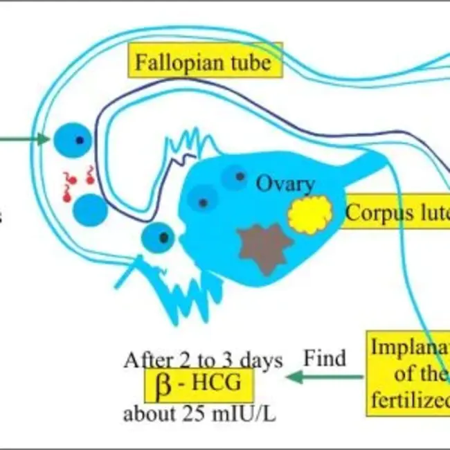 beta-human chorionic gonadotrophic hormone : β-人绒毛膜促性腺激素