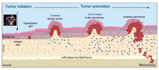 Tumor Response : 肿瘤反应