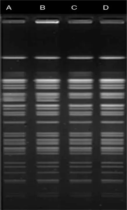 carbapenem-resistant Klebsiella pneumoniae : 耐碳青霉烯类肺炎克雷伯菌