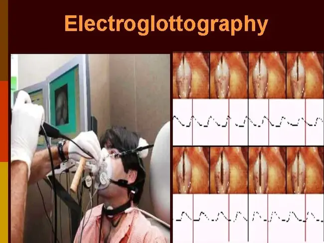 electroglottography : 电子舌片描记术