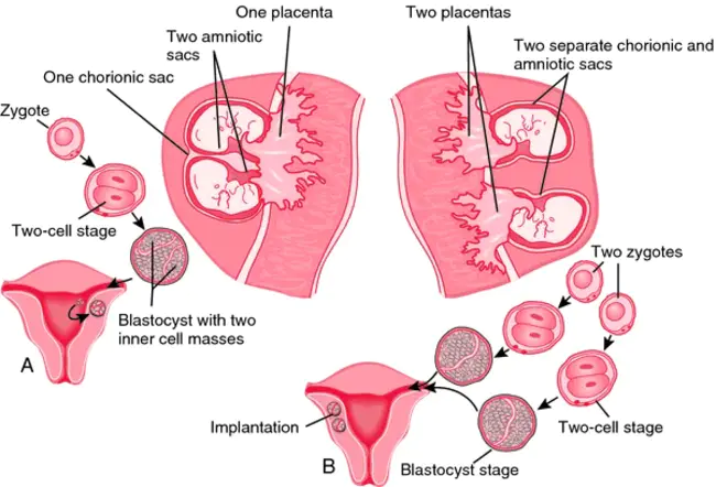 monozygotic : 单合子的