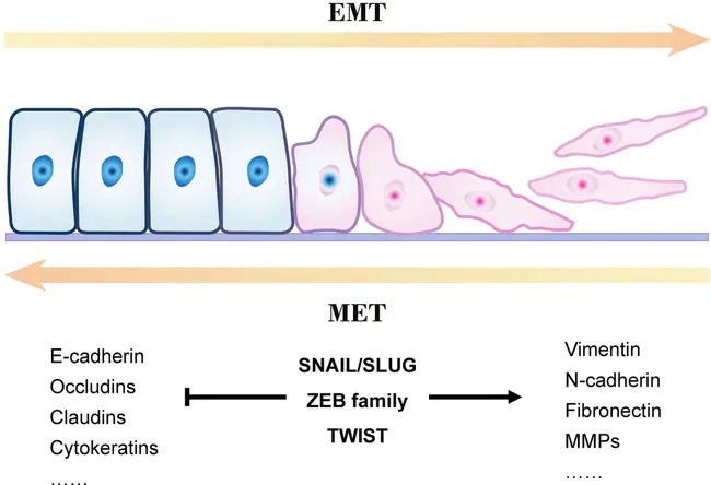 Epithelial-Mesenchymal Transition : 上皮间充质转变