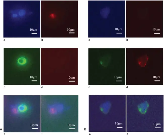 Circulating Tumor Cell(S) : 循环肿瘤细胞