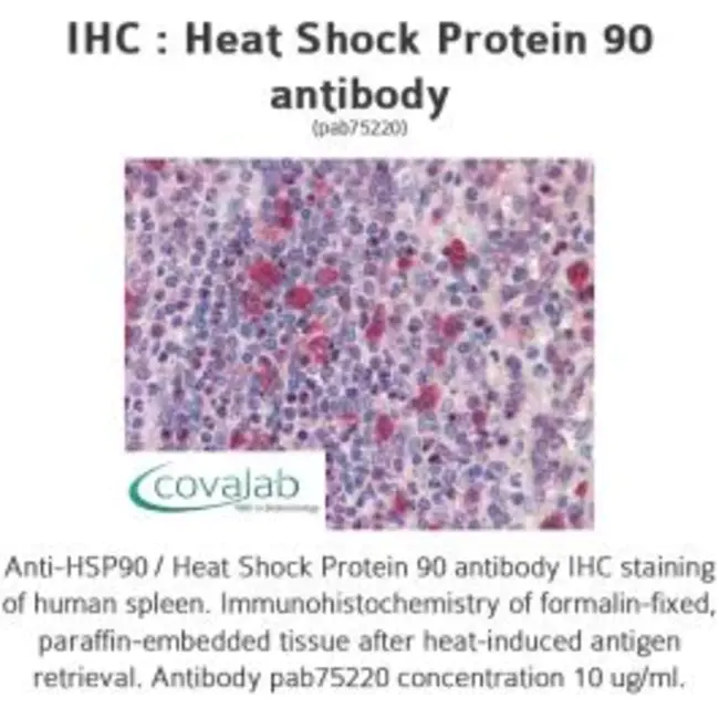 Heat-Shock Protein : 热休克蛋白