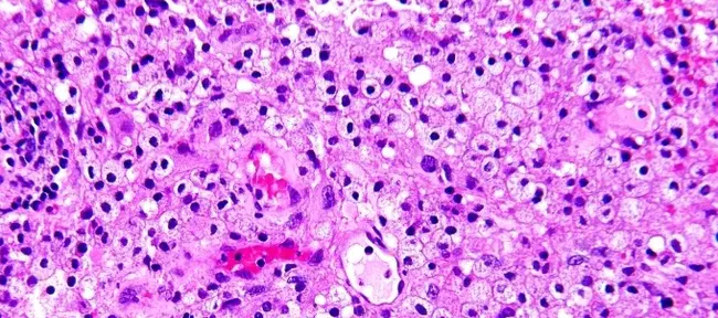 Hematoxylin and Eosin : 苏木精和伊红